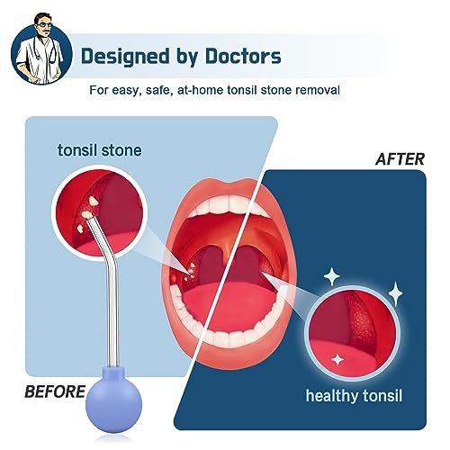 Tonsil Stone Vacuum, 9 Pcs Tonsil Stone Remover, Tonsil Stone Removal kit Vacuum Suction, Tonsil Stone Cupping Tool, Tonsil Stone Removal Tool with Oral Light, 5X Magnifying Mirror, Tongue Depressor