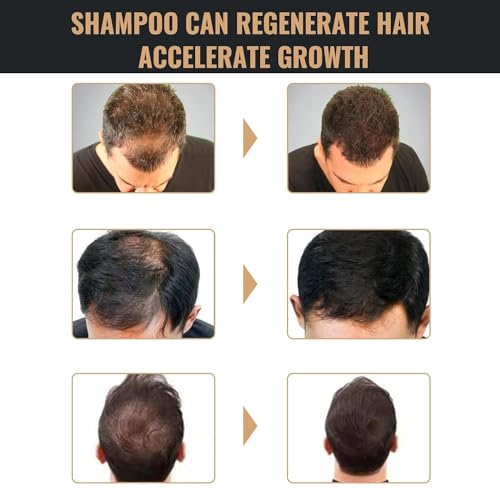 Root Activator Shampoo, Hair Growth Root Activator Shampoo, For Anti-Hair Loss, Natural Formula for Men and Women（100ML）