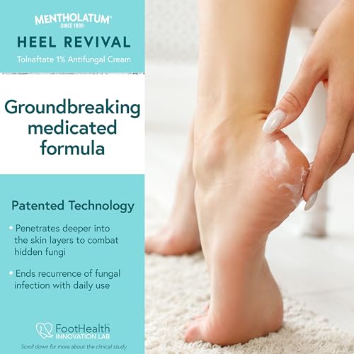 Mentholatum Heel Revival, Persistent Cracked Heel Repair Treatment, 1% Tolnaftate Antifungal Cream, Antifungal Foot Treatment, Eliminates & Prevents Fungus, 1 OZ