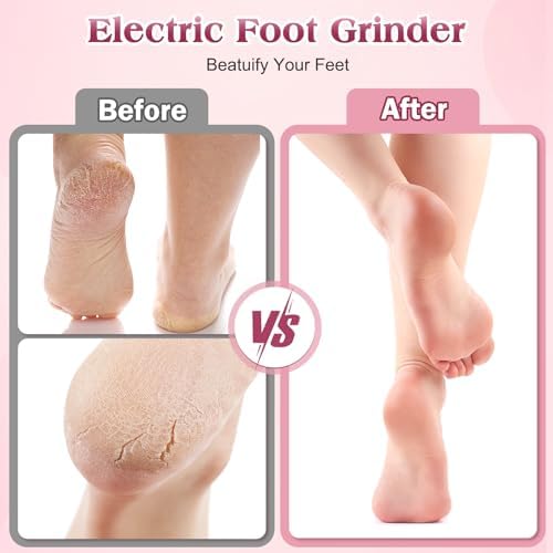 Electric Foot Callus Remover, Electric Foot File for Feet with Adjustable Speed Controller and 60pcs Replacement Sandpaper Disk for Dead Skin and Calluses, for Women&Men, Gradient Pink