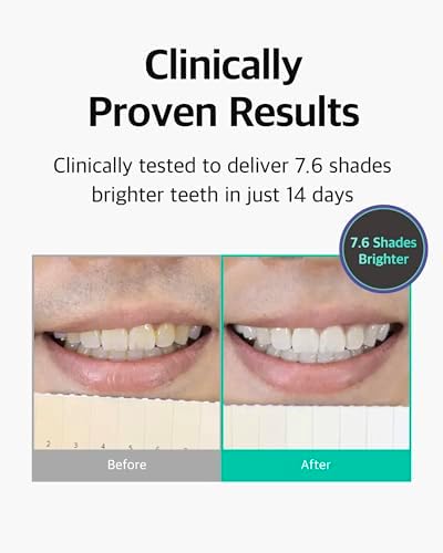 Live Orals PureDia Teeth Whitening Kit - Gel & Mouthpiece Set, Hydrogen Peroxide, Dentist Formulated for Sensitive Teeth, 28 Treatments.