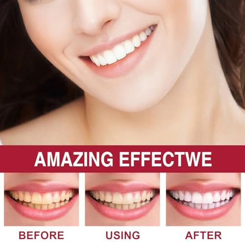 2 Pcs Sp-6 Probiotic Ultra Whitening Toothpaste, Sp 6 Toothpaste, Deep Cleaning Care, Stain Removing, Fresh Breath.
