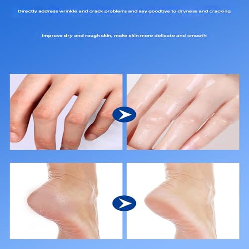 Equrhsa Foot Care Cream Cracked Feet, Equrhsa Crack Feet Prevention Stick, Anti Cracking Foot Cream Roll On, Foot Balm Stick for Dry Cracked Feets, Hydrating, Deep Moisturizing (2PC-Mix)