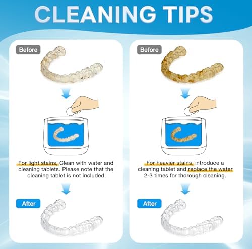 Ultrasonic Retainer Cleaner 45kHz, 250ML Portable Jewelry Cleaner, Professional Retainer Cleaner Machine for Denture, Mouth Guard, Aligner