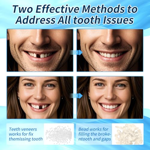 Tooth Repair kit for Filling The Missing Broken Tooth and Gaps-Moldable Fake Teeth and Thermal Beads Replacement Kit-Natural Color-B01