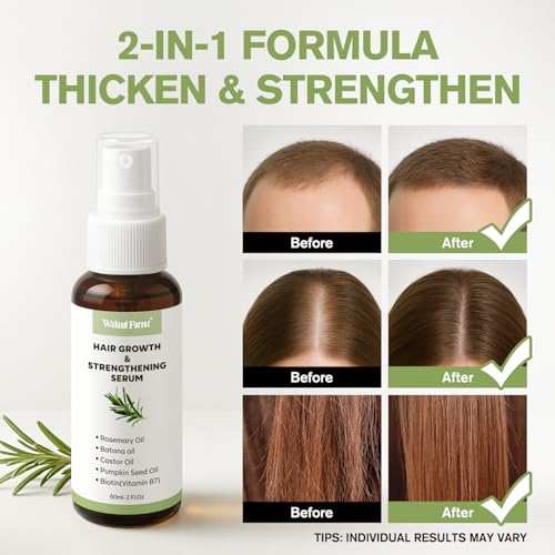 Rosemary Oil Hair Growth Spray, Thickening Hair & Scalp Serum, Nourishing Formula with Castor, Batana, Biotin for Hair Growth, Promotes Fuller Follicles for Women & Men – All Hair Types (2 Oz, 1 Pack)