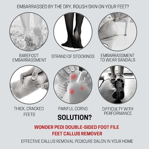 Made in Germany Double Sided Metal Foot File - Stainless Steel Feet Callus Remover - Feet Scrubber Dead Skin - Heel Scraper Cracked Heels Repair Professional Foot Rasp.