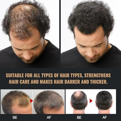 Root Activator Shampoo, Natural Hair Regrōwth Shampoos for Men Women 2bottles (100ml/1 Bottles)