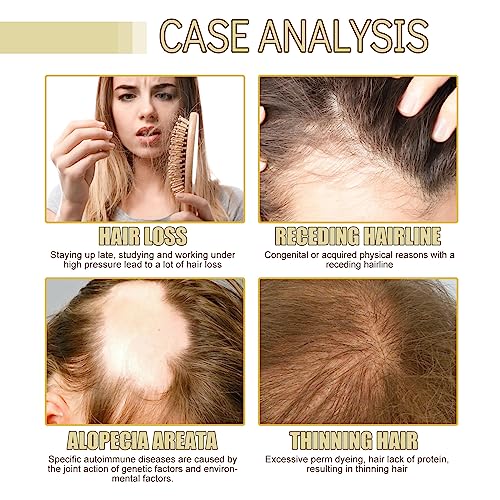 180 ML Eelhoe Hair Growth Oil, Carvenchi Natural Hair Growth Organic Rosemary Oil for Dry Damaged Hair and Growth Thin Hair.