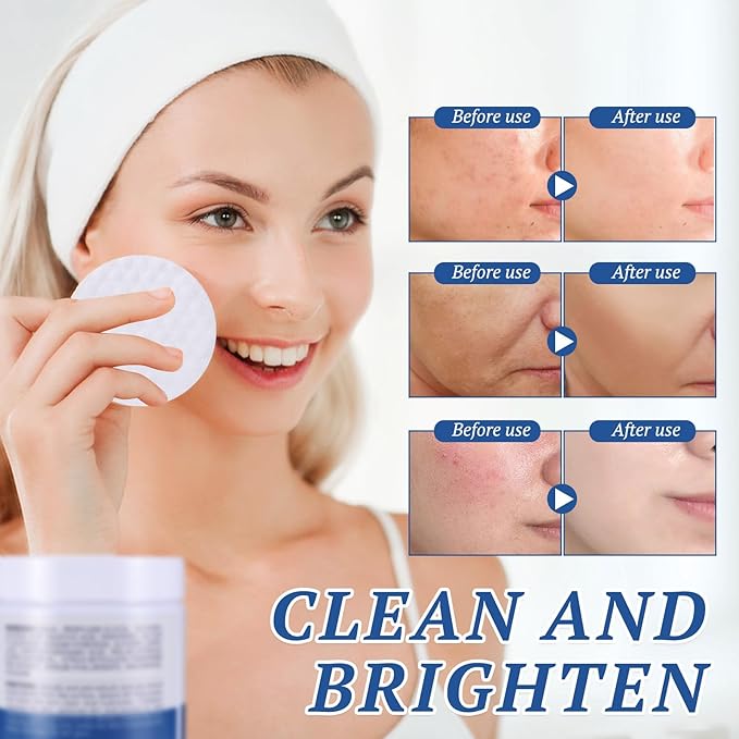 Glycolic Acid Pads,Glycolic Acids Peel Pad,Glycoli c Exfoliating Pad,Exfoliating Peel for Face & Body Exfoliat ing Skin, Reduce Fine Lines Wrinkles - 60 Pads (2PCS)