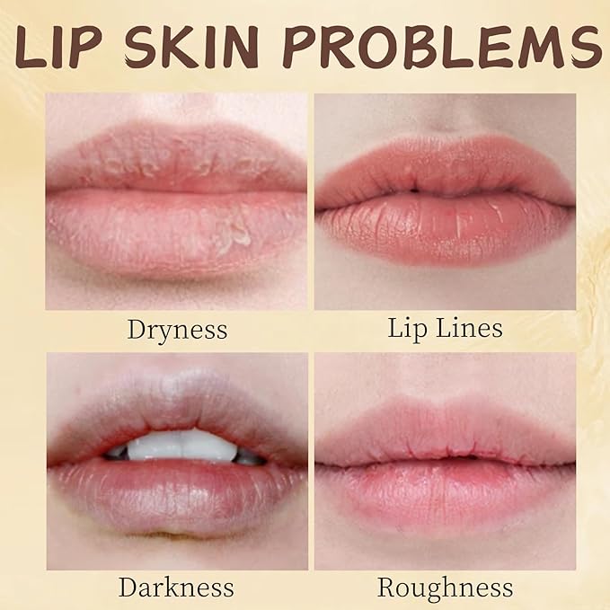8PCS Bee Lip Balm Honey Pot - Lip Sleeping Mask - Lip Gloss for Women - Lip Mask Overnight Gift Set - Tinted Lip Balm - Easter Gifts - Honey,Cherry,Strawberry,Apple Lime,Watermelon,Mint,Coconut,Peach
