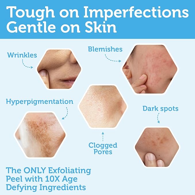 Era Organics Glycolic Acid Peel AHA BHA Exfoliant - 70% USP Grade Clinical Strength Age-Defying At Home Chemical Exfoliant for Face - Salicylic and Lactic Acid, Aloe Vera, Manuka Honey