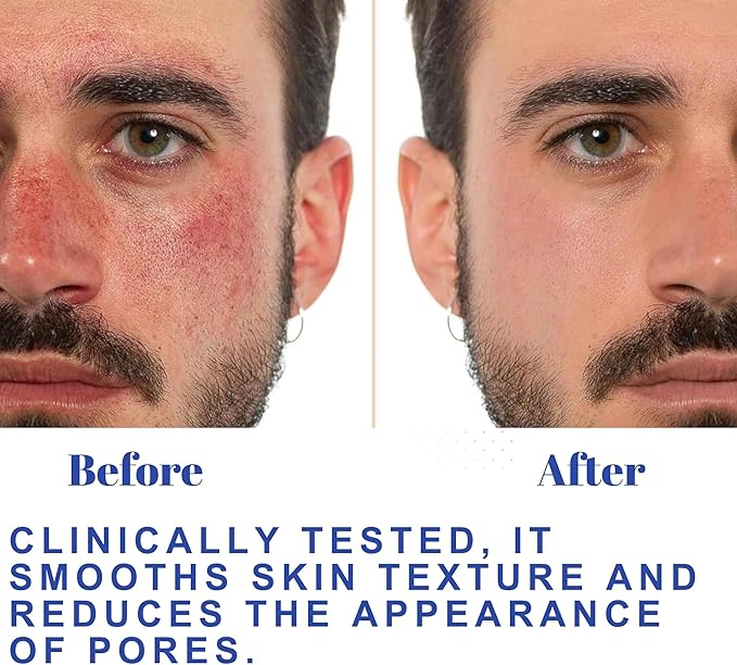Hydrating Toner for Face, Refreshing Facial Mist with Witch Hazel, Rose Water, Salicylic & Glycolic Acid | A Zero Pore Cleanser, Helps Fade Dark Spots & Minimize Pores, Alcohol-Free Toner, 100 ml