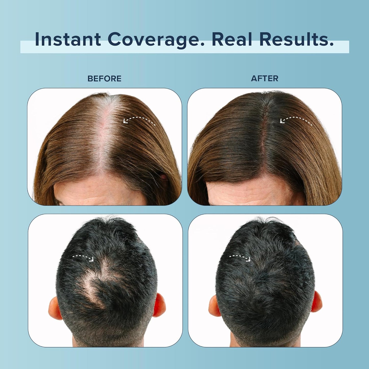 TRUHAIR Color Fibers Root Coverage & Density Booster | Quick-Apply Touch Up Hair Color | Natural Matching, Gray Hair Cover Up - 11 Colors Available (Blonde)